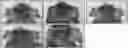 Fig. 01 - PHARMACEUTICAL COMPOSITION COMPRISING 6-DIAZO-5-OXO-L-NORLEUCINE FOR TREATING INFLAMMATORY SKIN DISEASE