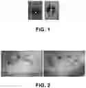 Fig. 02 - Oral compositions for post-dental implants