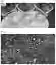 Fig. 02 - Methods of increasing blood oxygen saturation