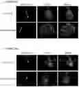 Fig. 30 - NOVEL ANUCLEATED CELLS AND USES THEREOF