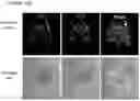 Fig. 43 - NOVEL ANUCLEATED CELLS AND USES THEREOF