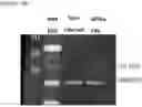 Fig. 61 - NOVEL ANUCLEATED CELLS AND USES THEREOF