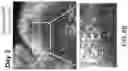 Fig. 35 - METHODS TO ENHANCE T CELL REGENERATION