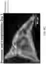 Fig. 41 - METHODS TO ENHANCE T CELL REGENERATION