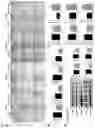 Fig. 17 - COMPOSITION FOR PREVENTING OR TREATING NEUROINFLAMMATORY DISORDERS, COMPRISING BEE VENOM EXTRACT AS ACTIVE INGREDIENT