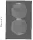 Fig. 11 - Methods and compositions for treating mucosal tissue disorders