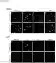 Fig. 24 - Compositions for treating heart disease by inhibiting the action of mAKAP-β