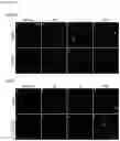 Fig. 26 - Compositions for treating heart disease by inhibiting the action of mAKAP-β
