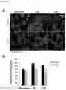 Fig. 27 - Compositions for treating heart disease by inhibiting the action of mAKAP-β