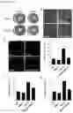 Fig. 34 - Compositions for treating heart disease by inhibiting the action of mAKAP-β