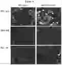 Fig. 12 - ANTI-CD6 ANTIBODY COMPOSITIONS AND METHODS FOR TREATING LUPUS