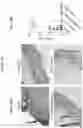 Fig. 17 - ANTI-CD6 ANTIBODY COMPOSITIONS AND METHODS FOR TREATING LUPUS