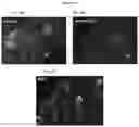 Fig. 18 - ANTI-CD6 ANTIBODY COMPOSITIONS AND METHODS FOR TREATING LUPUS
