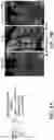 Fig. 17 - COMPOSITIONS AND METHODS FOR MODULATING CGRP SIGNALING TO REGULATE INTESTINAL INNATE LYMPHOID CELLS