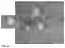 Fig. 17 - COMPOSITIONS, METHODS AND USES FOR THERMALLY STABLE HUMAN PAPILLOMAVIRUS FORMULATIONS