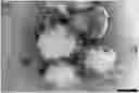 Fig. 01 - ACOUSTIC DRIVEN DRUG DELIVERY SYSTEMS