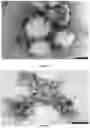 Fig. 07 - ACOUSTIC DRIVEN DRUG DELIVERY SYSTEMS