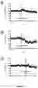 Fig. 29 - ACOUSTIC DRIVEN DRUG DELIVERY SYSTEMS