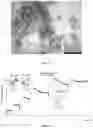 Fig. 32 - ACOUSTIC DRIVEN DRUG DELIVERY SYSTEMS
