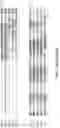 Fig. 15 - Anti-CD25 antibody-maytansine conjugates and methods of use thereof