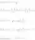Fig. 23 - Anti-CD25 antibody-maytansine conjugates and methods of use thereof