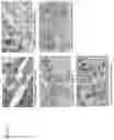 Fig. 17 - METHODS FOR INCREASING EFFICACY OF FOLR1 CANCER THERAPY