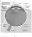 Fig. 04 - Gene Therapy For Eye Pathologies
