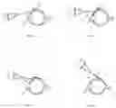 Fig. 05 - Gene Therapy For Eye Pathologies