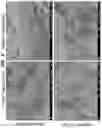 Fig. 04 - Acoustic extracellular matrix hydrogels and their use