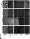 Fig. 19 - Acoustic extracellular matrix hydrogels and their use