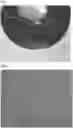 Fig. 01 - INTRAOCULAR LENS COMPOSITIONS