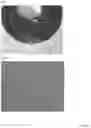 Fig. 02 - INTRAOCULAR LENS COMPOSITIONS