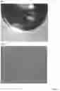 Fig. 04 - INTRAOCULAR LENS COMPOSITIONS