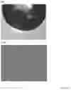 Fig. 10 - INTRAOCULAR LENS COMPOSITIONS
