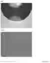 Fig. 11 - INTRAOCULAR LENS COMPOSITIONS