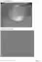 Fig. 15 - INTRAOCULAR LENS COMPOSITIONS