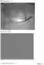 Fig. 16 - INTRAOCULAR LENS COMPOSITIONS