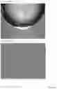 Fig. 17 - INTRAOCULAR LENS COMPOSITIONS
