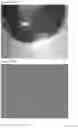 Fig. 19 - INTRAOCULAR LENS COMPOSITIONS
