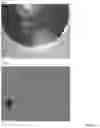 Fig. 21 - INTRAOCULAR LENS COMPOSITIONS