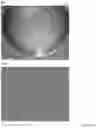 Fig. 22 - INTRAOCULAR LENS COMPOSITIONS