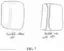 Fig. 08 - VASCULARIZING DEVICES AND METHODS FOR IMPLANTED DIAGNOSTICS AND THERAPEUTICS