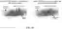 Fig. 11 - VASCULARIZING DEVICES AND METHODS FOR IMPLANTED DIAGNOSTICS AND THERAPEUTICS