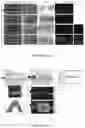 Fig. 26 - VASCULARIZING DEVICES AND METHODS FOR IMPLANTED DIAGNOSTICS AND THERAPEUTICS