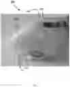 Fig. 03 - REINFORCED BIOCOMPATIBLE SCAFFOLD