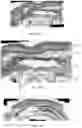 Fig. 04 - Biodegradable Mesh Implant for Soft Tissue Repair