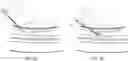 Fig. 03 - Endovascular implants and devices and methods for accurate placement