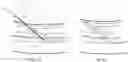 Fig. 04 - Endovascular implants and devices and methods for accurate placement