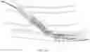Fig. 14 - Endovascular implants and devices and methods for accurate placement