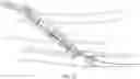Fig. 18 - Endovascular implants and devices and methods for accurate placement